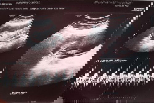 Sure boy na kaya si baby ko? Hahaha