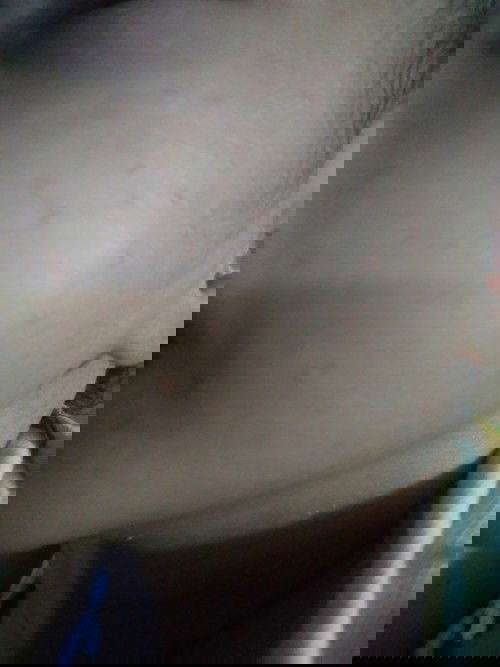 Bintik merah di wajah bayi 14hari