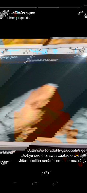 USG 34w6d Alhamdulillah sehat normal semuanya,BB udah 2,8