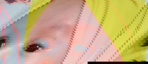 Mata sipit sebelah, kelopak mata turun