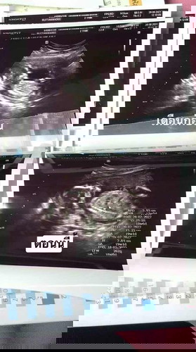 ขอดูใบซาวแม่ๆตอน19w