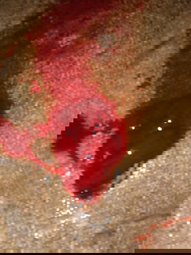 Kailangan ba iraspa kahit marming buong dugo ang lumabas at kaunti na lang kinabukasan?