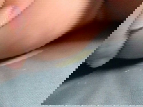 ปลูกฝีเด็กทารก ..ตอนนี้ลูกได้ เดือนกว่า...ทำไมไม่มีหนองคะ..มีแต่ตุ้มสีตามผิวเค้าเลย..ปกติอยู่ไหมคะ