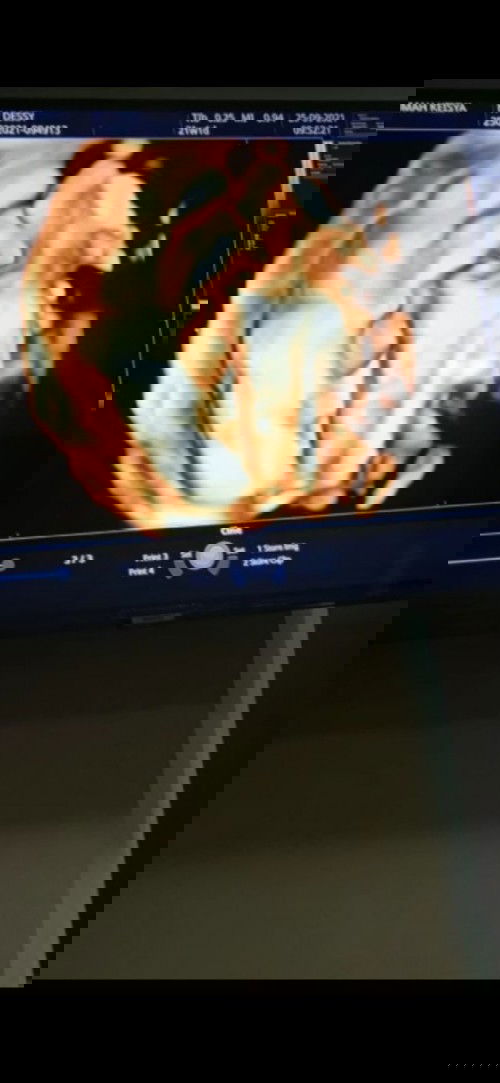 MashaAllah Tabarakallah 21 Weeks 😀