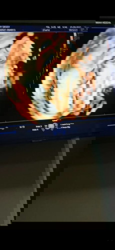 MashaAllah Tabarakallah 21 Weeks 😀