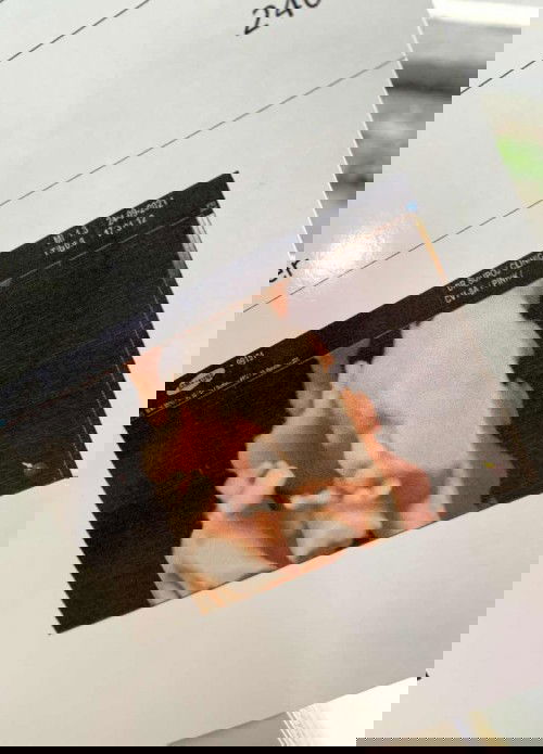 ก่อนผ่าตัดคลอด