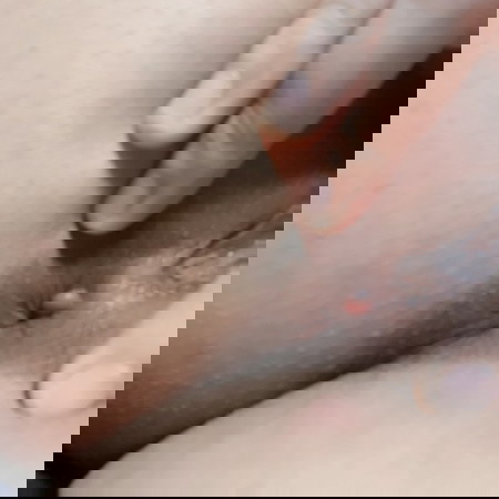 Ano pong gamot dito sa tumubo sa pwet ko? I think hemorrhoids? Pero sa tingin nyo?