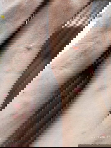 Insect bites