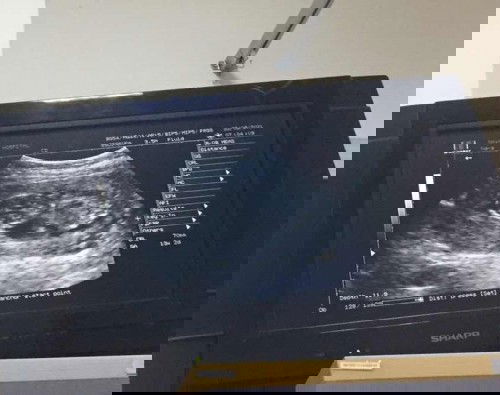 เเม่ๆว่าแบบนี้ ผู้หญิง ผู้ชาย กันนะ 🥰😚 ดูออกกันไหมค้ะ น้องทำท่าอะไรอยู่นะ