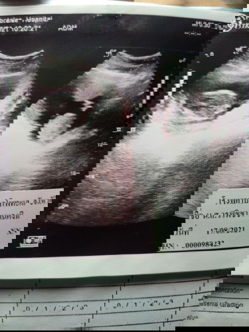 รบกวนแม่ๆทายเพศหน่อยได้มั้ยคะ