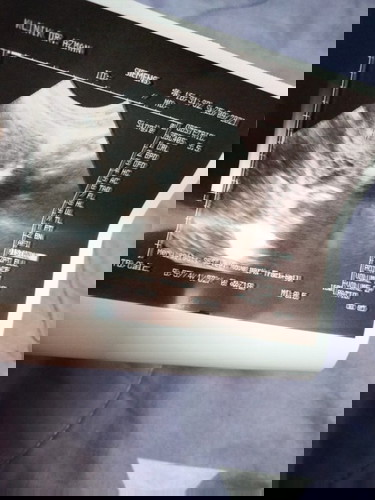 5week scan normal ke kalau xnampak jantung lagi