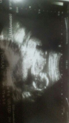 27Weekแล้ว👶👶👶