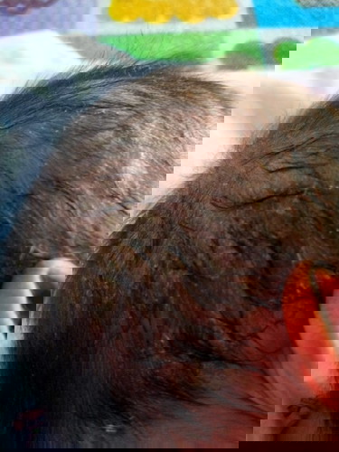 หัวน้องเป็นแบบนี้เป็นอะไรไหมค่ะกำลังจะพาไปหาหมอค่ะ