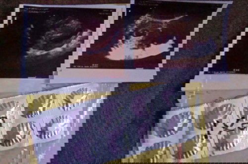 BO yg ke 2x nya(post 3 bulan yg lalu)