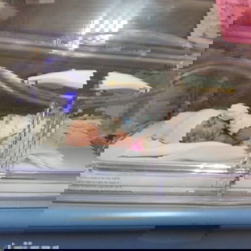 My Premature and Miracle baby