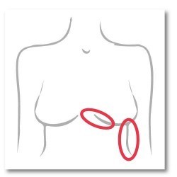 Sakit2 Belakang Badan / Sisi / Pangkal Breast