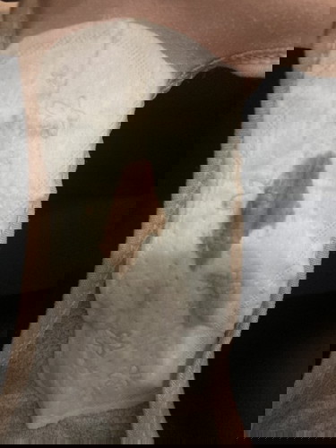 ตกขาวเป็นสีน้ำตาลเข้ม