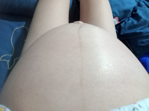 วันนี้เหมือนท้องสั่นข้างในแต่ไม่ได้สั่นออกมาข้างนอกท้องเลยแต่แม่รู้สึกได้ว่าสั่นแต่อยู่ในท้อง