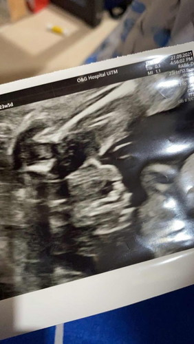 Baby boy or girl?