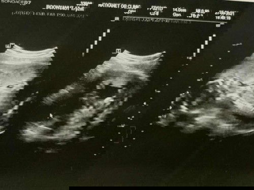 ลูกผู้ชายจ้า👦 ขอดูใบอันตราซาวของแม่ๆหน่อยจ้า