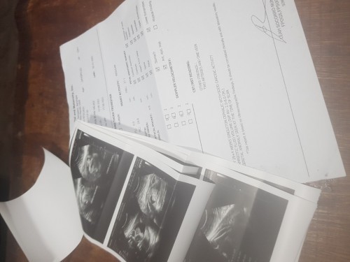 Cas ultrasound