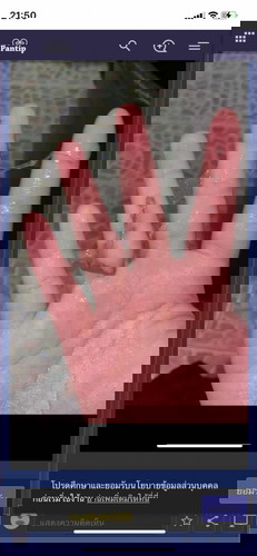 มีเมือกตกขาวสีน้ำตาล อายุครรภ์ 16+1