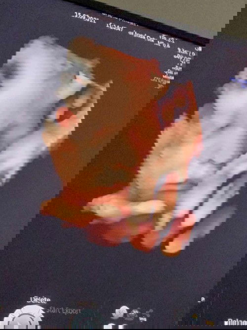 Hamil lagi saat masih menyusui