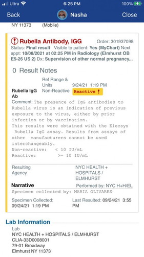 Rubella Antibody IGG, Test result