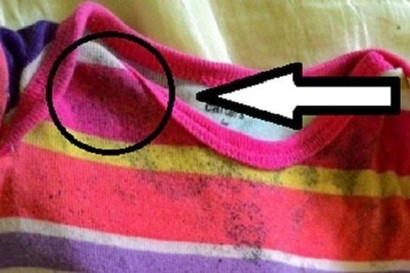 CARA MEMBASMI JAMUR DI BAJU BAYI