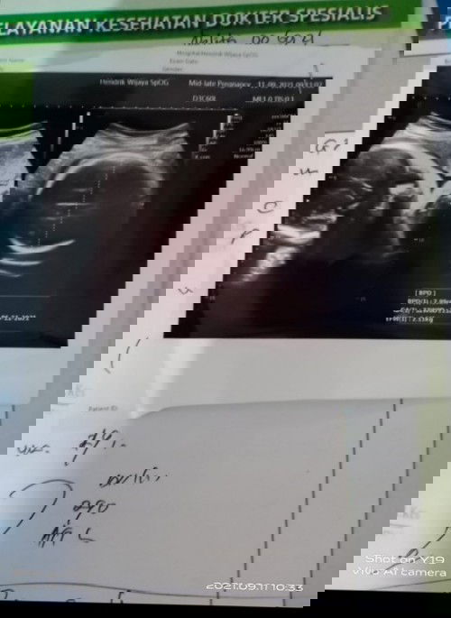 Anak Pertama Caesar...Anak Kedua??