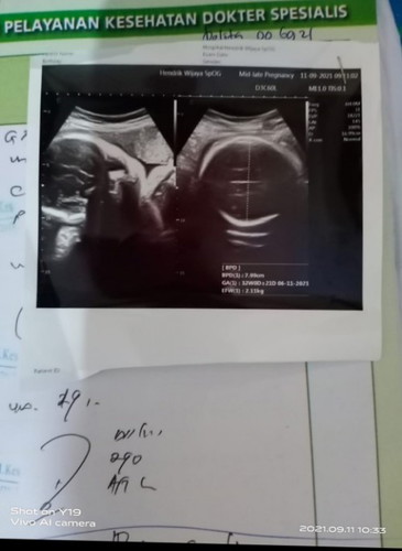 Anak Pertama Caesar...Anak Kedua??