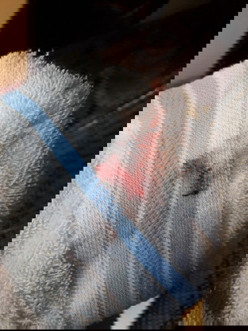 มีเลือดออก