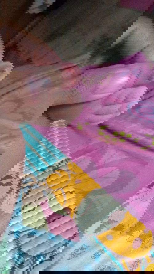 Cantengan pada kuku bayi