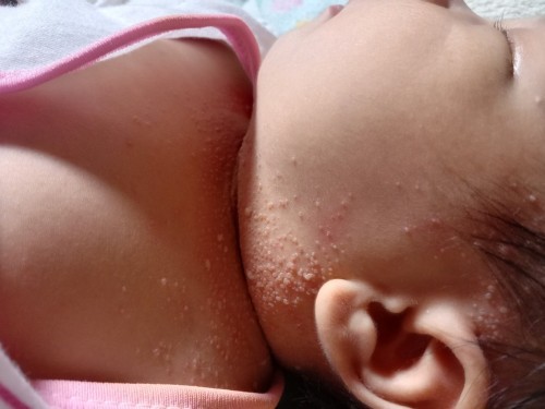 Bintik bayi