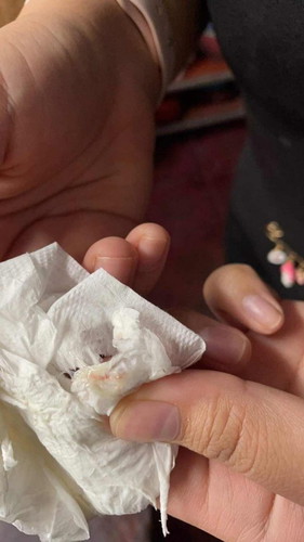 มีเลือดออกนิดนึงแบบนี้อันตรายมั้ยคะ จิตตกมากเลยค่ะ