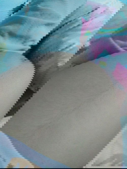 YELLOWISH DISCHARGE(PARANG SIPON)