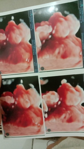 MasyaAllah jagoan ibu❤️