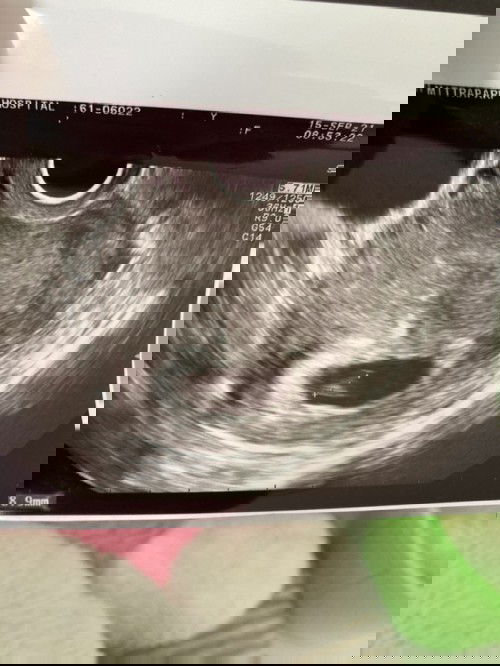 11สัปดาห์4วันกับการจากไป…