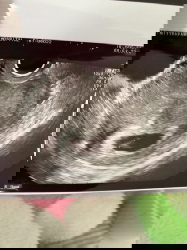 11สัปดาห์4วันกับการจากไป…