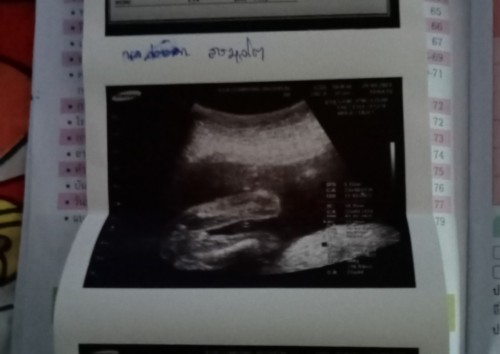 น้องเป็นผู้หญิงคะช่วยตั้งชื่อให้หน่อยคะพี่ชื่อน้ำหนึ่งน้องชื่ออะไรดีคะ