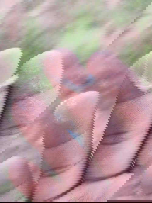 แบบนี้เรียกตกขาวหรือมูกใสคะ 37+1แล้วคะ