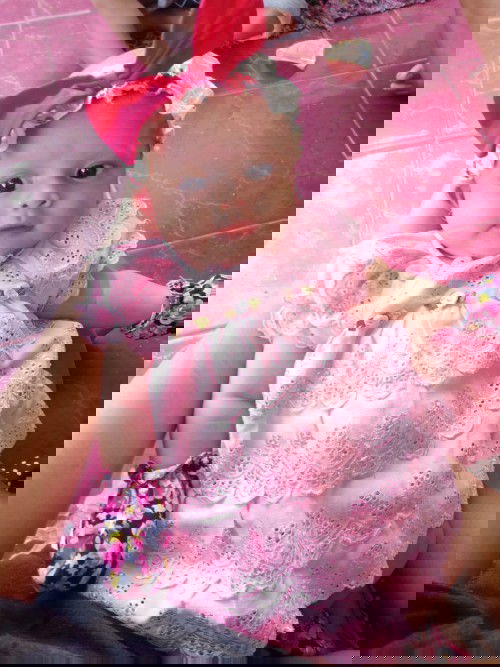 Bola mata bedah arah