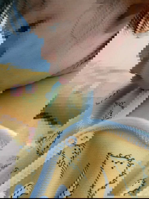 DEMAM NAIK TURUN, INGUSAN, BATUK-BATUK, RUAM MERAH DI KULIT, TELAPAK KAKI TANGAN BENGKAK.