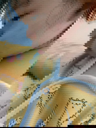 DEMAM NAIK TURUN, INGUSAN, BATUK-BATUK, RUAM MERAH DI KULIT, TELAPAK KAKI TANGAN BENGKAK.