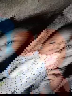 ขี้ตาแข็งตาแฉะ