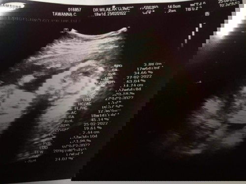 แม่ๆคนใหนซาวแล้วรู้เพศแล้วบ้างคะ