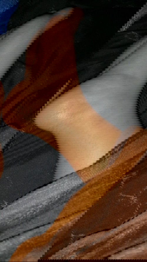 เท้าบวม​ 36w2d