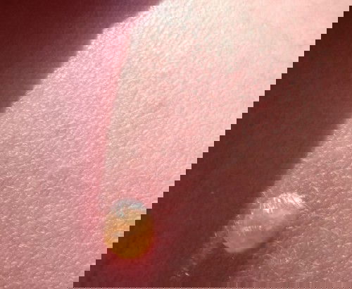 Muncul seperti nanah