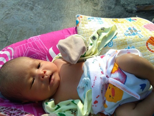 Bun ada yg kek aku gak, bayiku usia 7 hari jidatnya kek ada bruntus berair ada yg tau solusinya,?