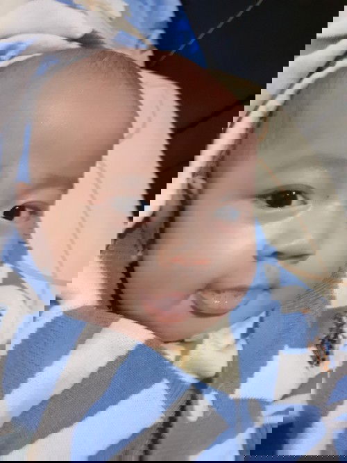 Tahi lalat pada bayi